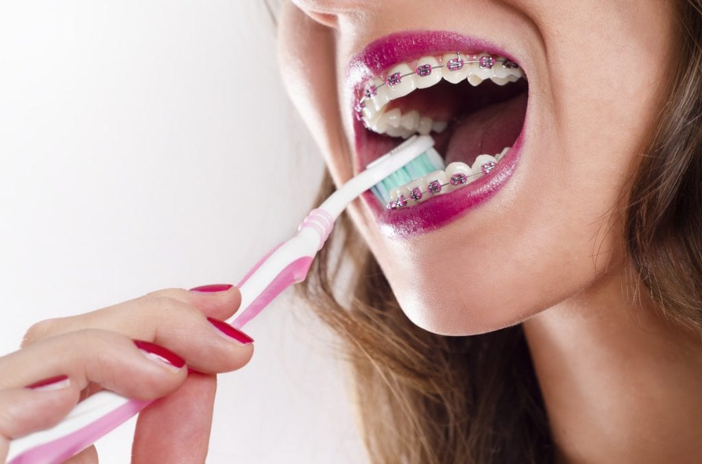 Hygiene Tips &amp; Tricks for Braces Wearers