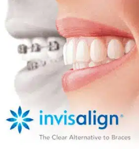 image of invisalign logo