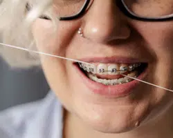 Braces and flossing Braces and flossing