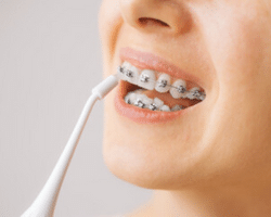 Dental irrigator Dental irrigator