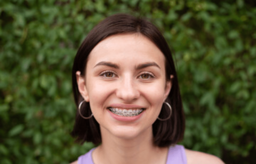Truth About Braces And Teeth Cleaning