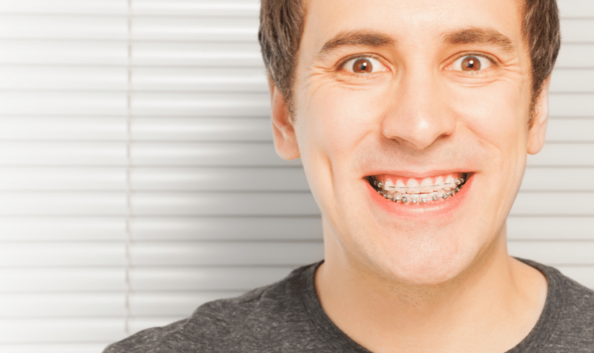 ceramic braces