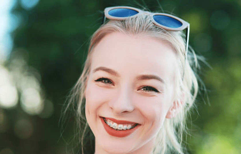 Braces Alexandria