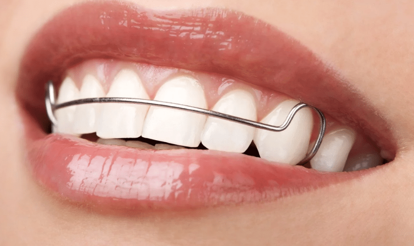 Retainer 
