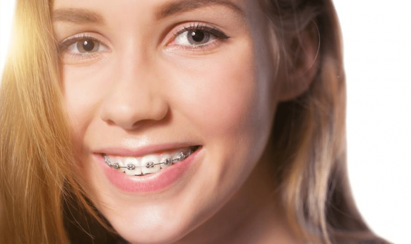 braces