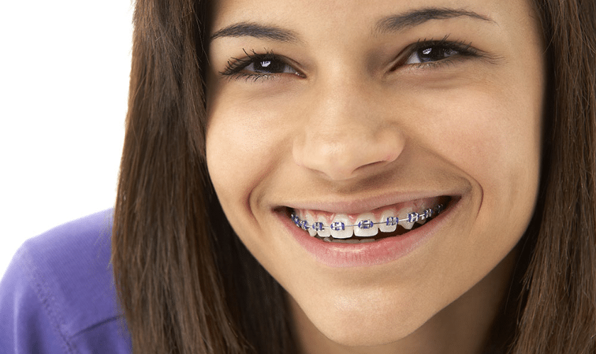braces