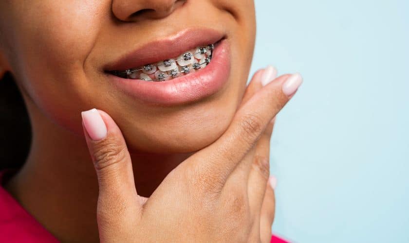 3 Benefits of Clear Braces - Alexandria Old Town Dental Alexandria Virginia