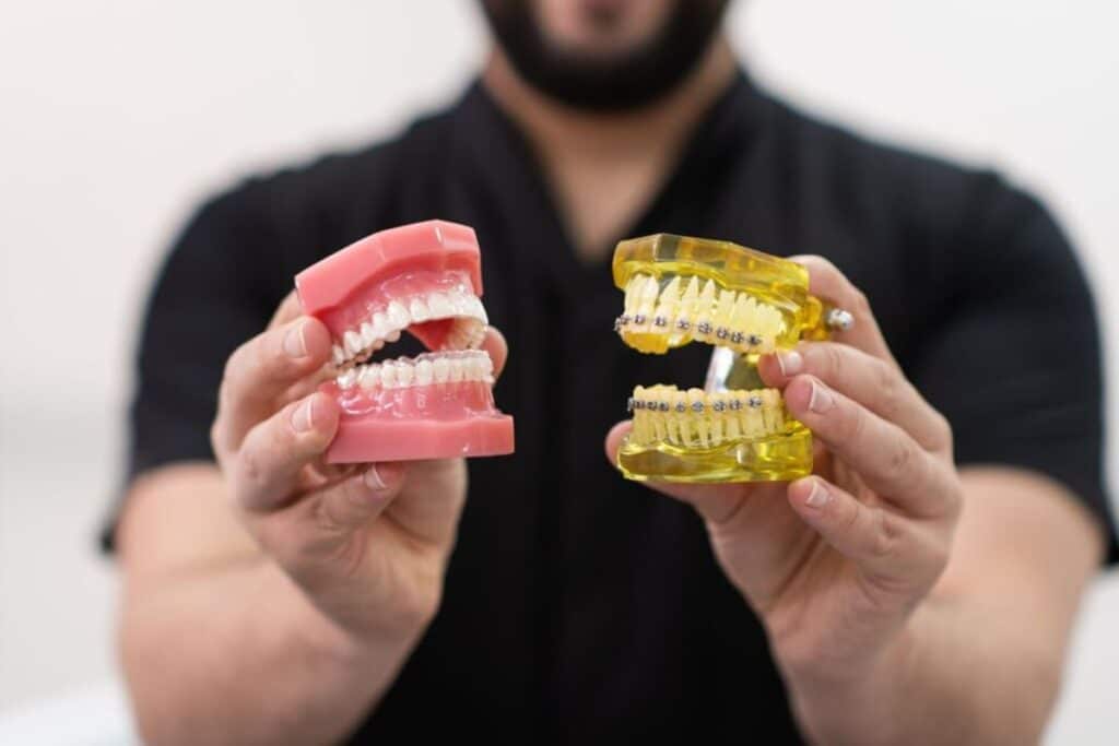 Braces vs. Clear Aligners