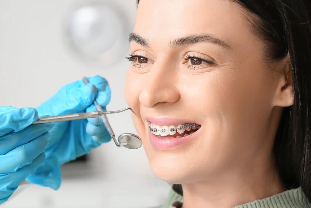 Braces Treatment in Alexandria