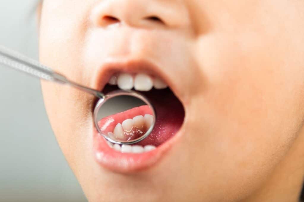 Orthodontic Treatment Orthodontic Treatment