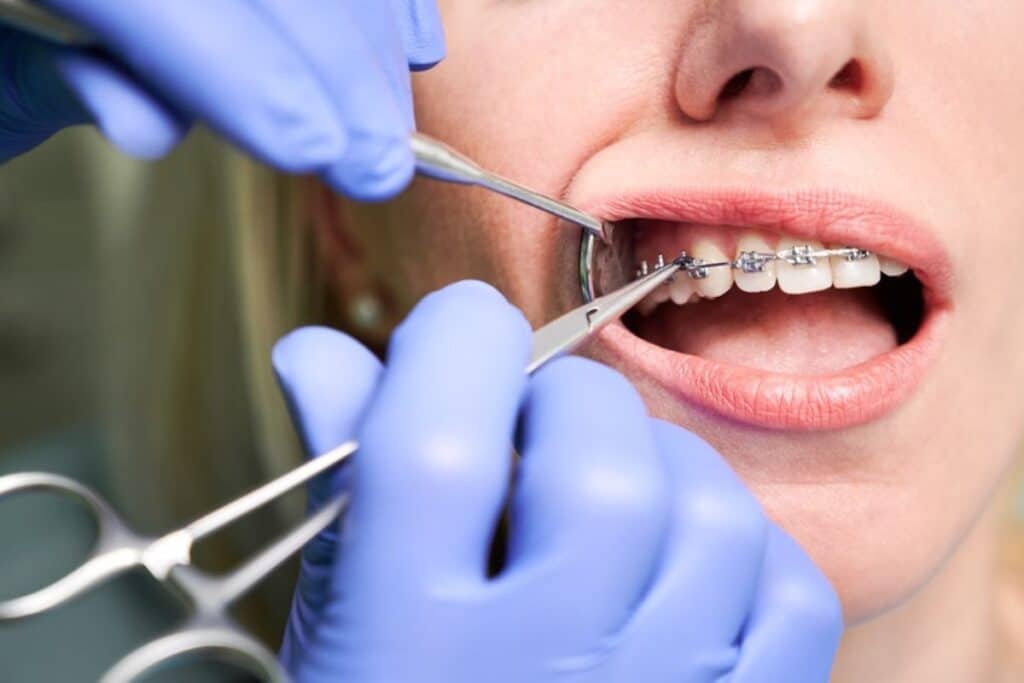 Orthodontist Orthodontist