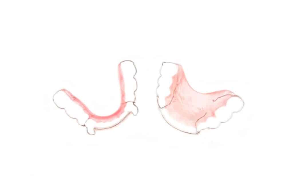 Retainers Retainers
