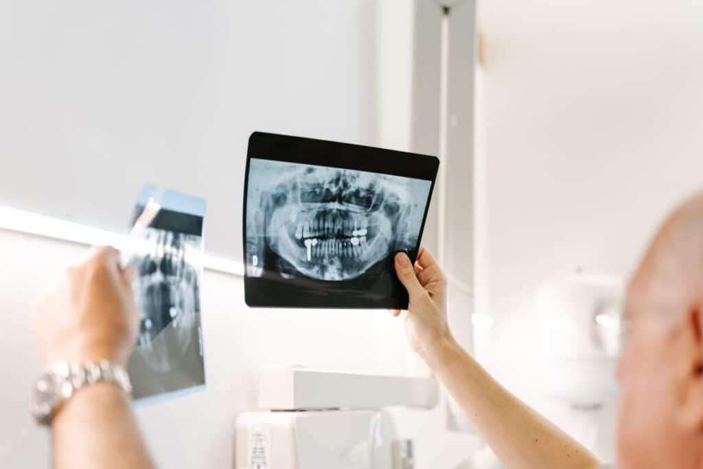 Digital X-Rays for Adults Digital X-Rays for Adults