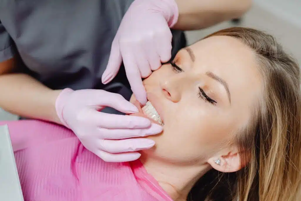 Orthodontic Treatment