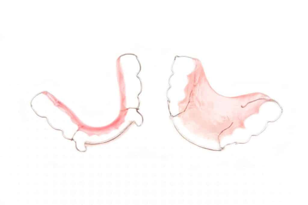 Retainers Problem